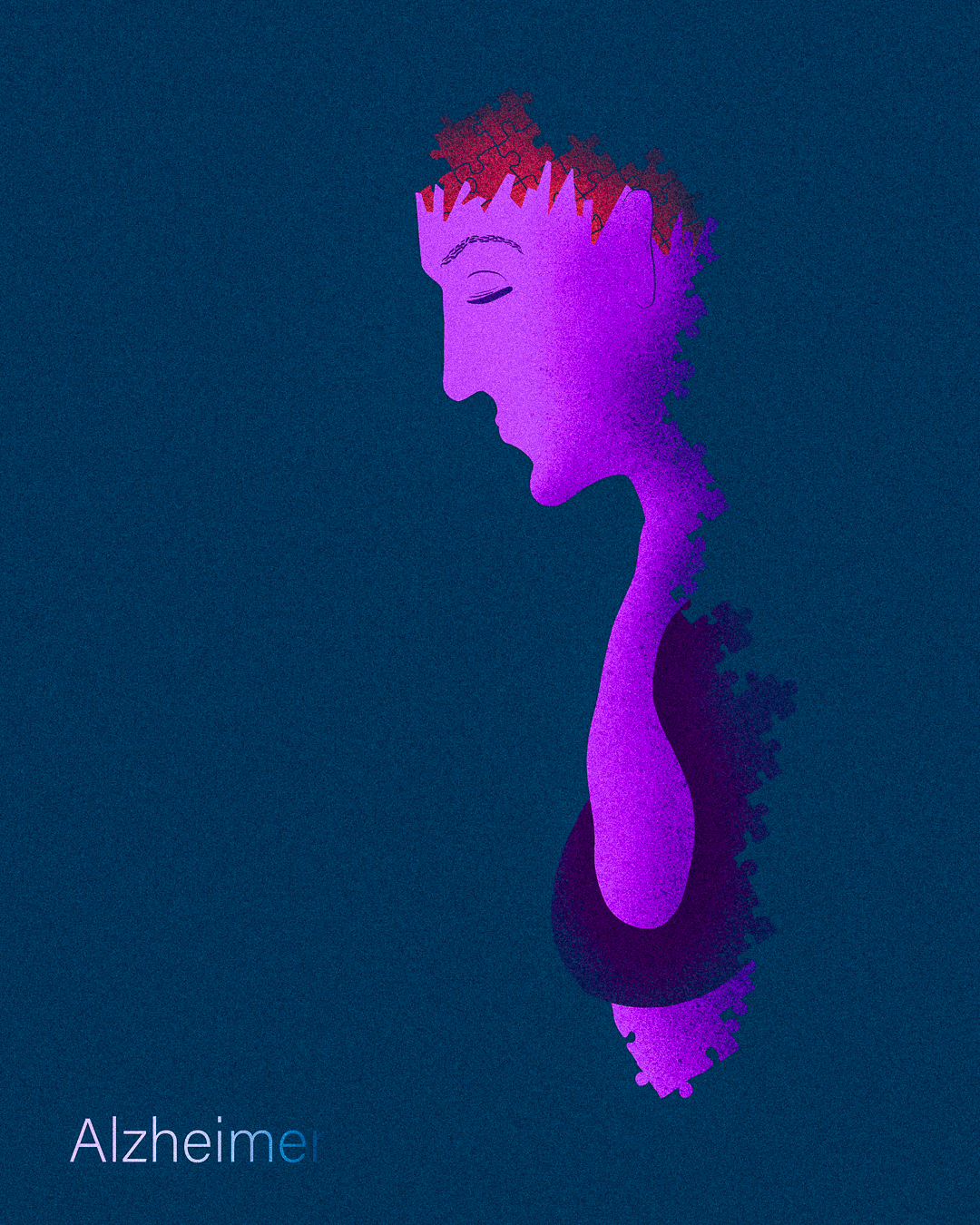 Mental Disorders - Alzheimer